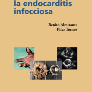 ACTUALIZACION EN LA ENDOCARDITIS INFECCIOSA
