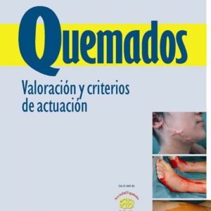 QUEMADOS. VALORACION Y CRITERIO