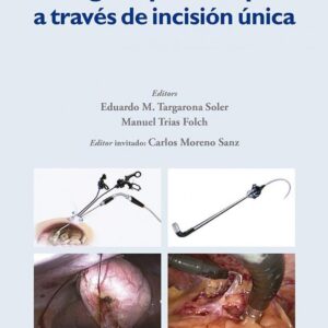 CIRUGIA LAPAROSCOPICA A TRAVES D