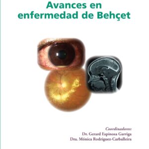 Avances en enfermedad de Behcet