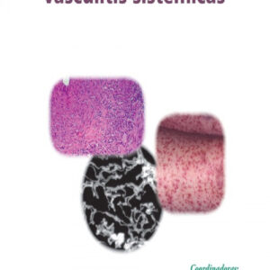 AVANCES EN VASCULITIS SISTEMICAS