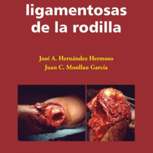 LESIONES LIGAMENTOSAS DE LA RODILLA