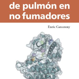 Carcinoma de pulmón en no fumadores