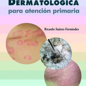 Guía dermatológica para atención primaria