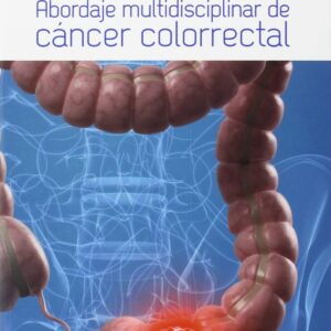 Abordaje multidisciplinar de cáncer colorrectal