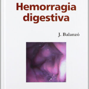 Hemorragia digestiva