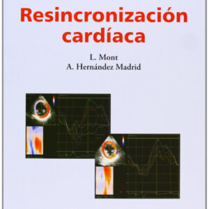 Resincronizacion cardiaca