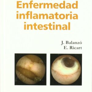 Enfermedad inflamatoria intestinal