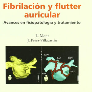 Fibrilación y flutter auricular