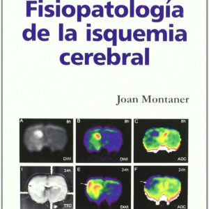Fisiopatología de la isquemia cerebral