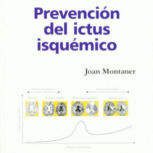 Prevención del ictus isquémico