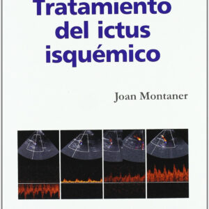Tratamiento del ictus isquémico