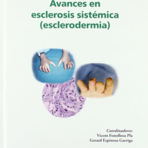 Avances en esclerosis sistémica (esclerodermia)
