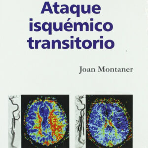 Ataque isquémico transitorio