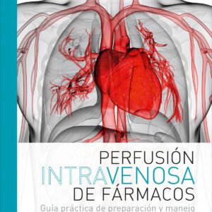 Perfusión intravenosa de fármacos