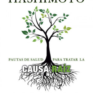 TIROIDITIS DE HASHIMOTO