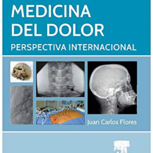 Medicina del dolor