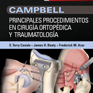 PRINCIPALES PROCEDIMIENTOS EN CIRUGÍA ORTOPÉDICA Y TRAUMATOLOGÍA + EXPERTCONSULT