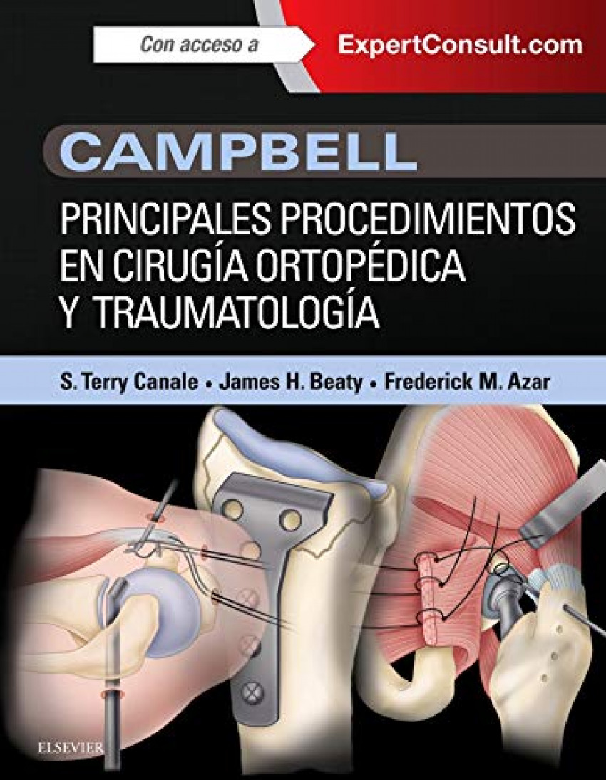 PRINCIPALES PROCEDIMIENTOS EN CIRUGÍA ORTOPÉDICA Y TRAUMATOLOGÍA + EXPERTCONSULT