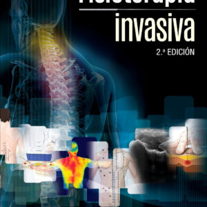 Fisioterapia invasiva