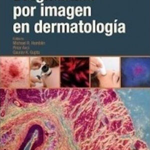 DIAGNÓSTICO POR IMAGEN EN DERMATOLOGÍA