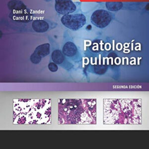 PATOLOGÍA PULMONAR +EXPERTCONSULT