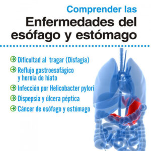 Comprender Las Enfermedades Del Esofago