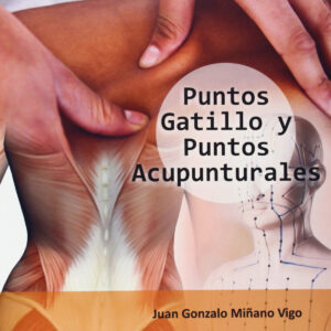 Puntos gatillo y puntos acupunturales