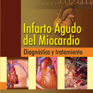 INFARTO AGUDO DEL MIOCARDIO