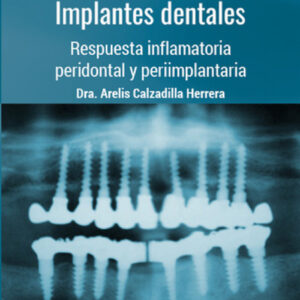 ESTOMATOLOGÍA. IMPLANTES DENTALES