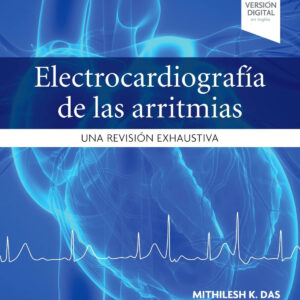 Electrocardiografía de las arritmias