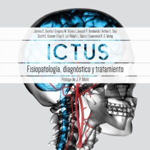 Ictus: Fisiopatología, diagnóstico y abordaje