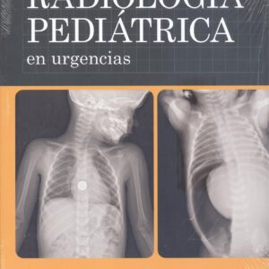 RADIOLOGIA PEDIATRICA EN URGENCIAS