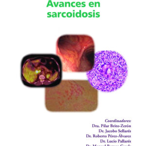Avances en sarcoidosis