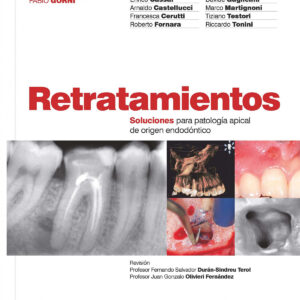 Retratamientos. Soluciones para patología apical de origen endodóntico