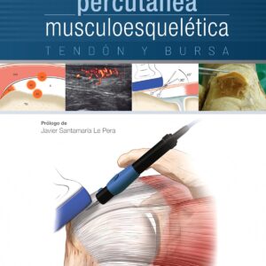 Electrolisis percutánea musculoesquelética. Tendón y bursa