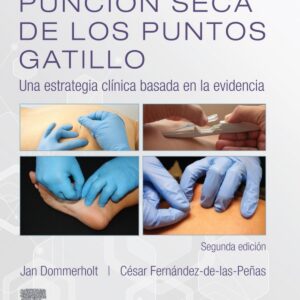 PUNCIÓN SECA DE LOS PUNTOS DE GATILLO