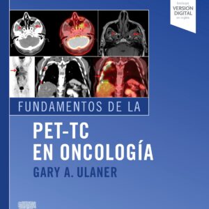 Fundamentos de la PET-TC en oncología