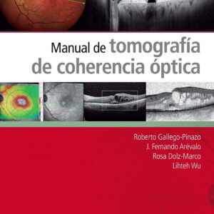 Manual de tomografía de coherencia óptica