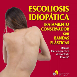 Escoliosis idiopática. Tratamiento conservador con bandas elásticas