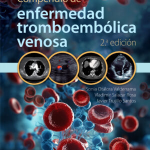 COMPENDIO DE ENFERMEDAD TROMBOEMBOLICA VENOSA 2ª ED