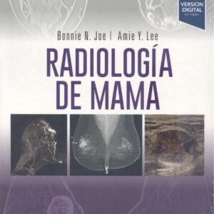 RADIOLOGIA DE MAMA 4ª ED