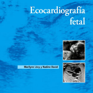 ECOCARDIOGRAFIA FETAL